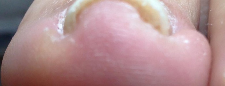 12316499_923432984412581_581764127037676911_n