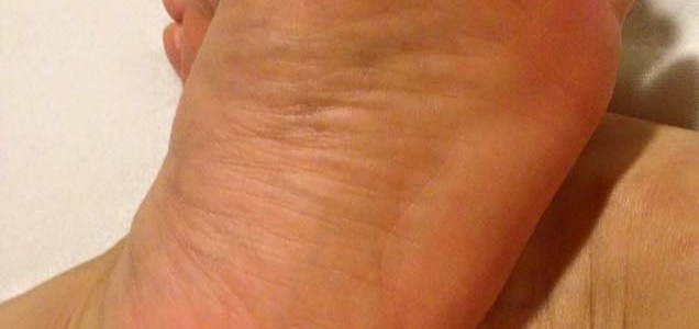 12321309_926551350767411_2537102327721120593_n